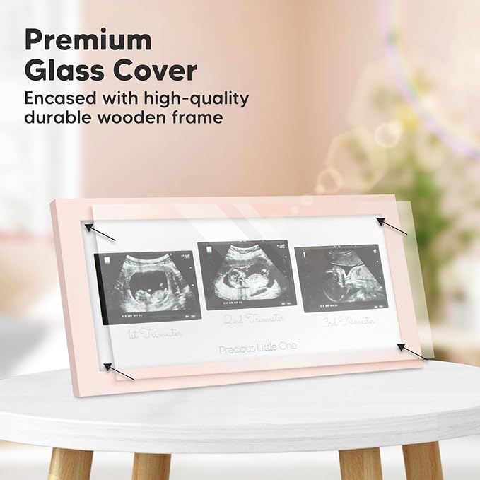 Keababies Sonogram Picture Frame and First 5 Years Baby Memory Book Journal - Trio Ultrasound Picture Frames For Mom To Be Gift - 90 Pages Hardcover First Year Keepsake Milestone Baby Book