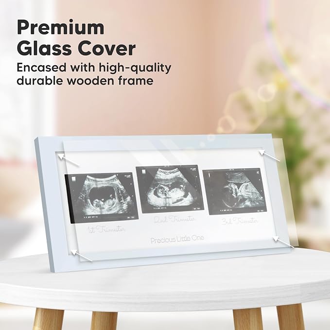 Keababies Sonogram Picture Frame and First 5 Years Baby Memory Book Journal - Trio Ultrasound Picture Frames For Mom To Be Gift - 90 Pages Hardcover First Year Keepsake Milestone Baby Book