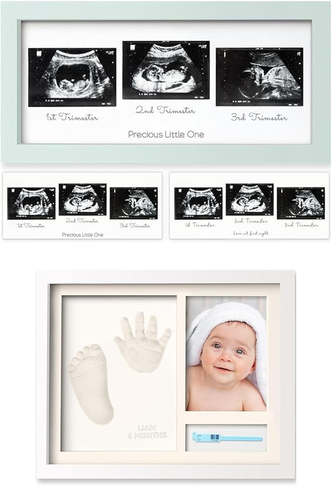 KeaBabies Sonogram Picture Frame and Baby Hand and Footprint Kit Maker - Trio Ultrasound Picture Frames For Mom To Be Gift - Newborn Baby Handprint Footprint Keepsake Frame, Baby Gifts