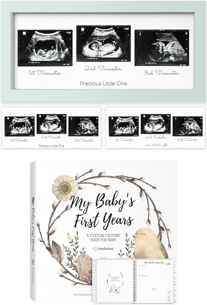 Keababies Sonogram Picture Frame and First 5 Years Baby Memory Book Journal - Trio Ultrasound Picture Frames For Mom To Be Gift - 90 Pages Hardcover First Year Keepsake Milestone Baby Book