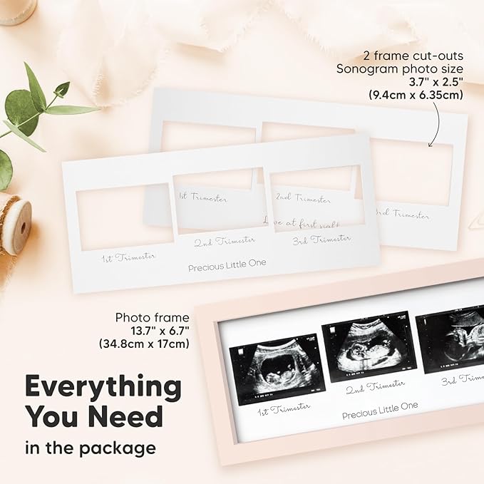 Keababies Sonogram Picture Frame and First 5 Years Baby Memory Book Journal - Trio Ultrasound Picture Frames For Mom To Be Gift - 90 Pages Hardcover First Year Keepsake Milestone Baby Book