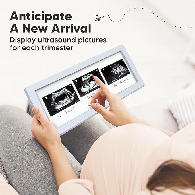 Keababies Sonogram Picture Frame and First 5 Years Baby Memory Book Journal - Trio Ultrasound Picture Frames For Mom To Be Gift - 90 Pages Hardcover First Year Keepsake Milestone Baby Book