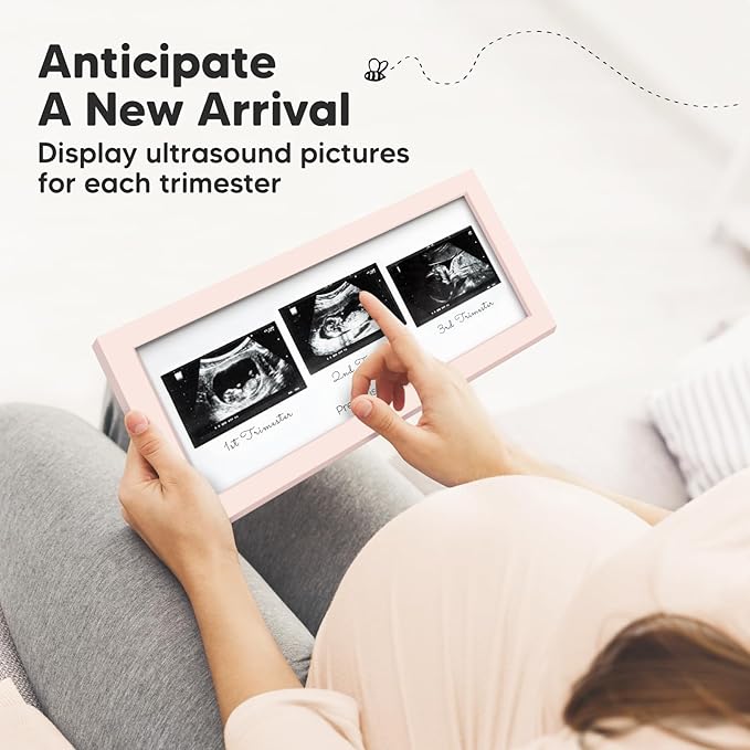 Keababies Sonogram Picture Frame and First 5 Years Baby Memory Book Journal - Trio Ultrasound Picture Frames For Mom To Be Gift - 90 Pages Hardcover First Year Keepsake Milestone Baby Book