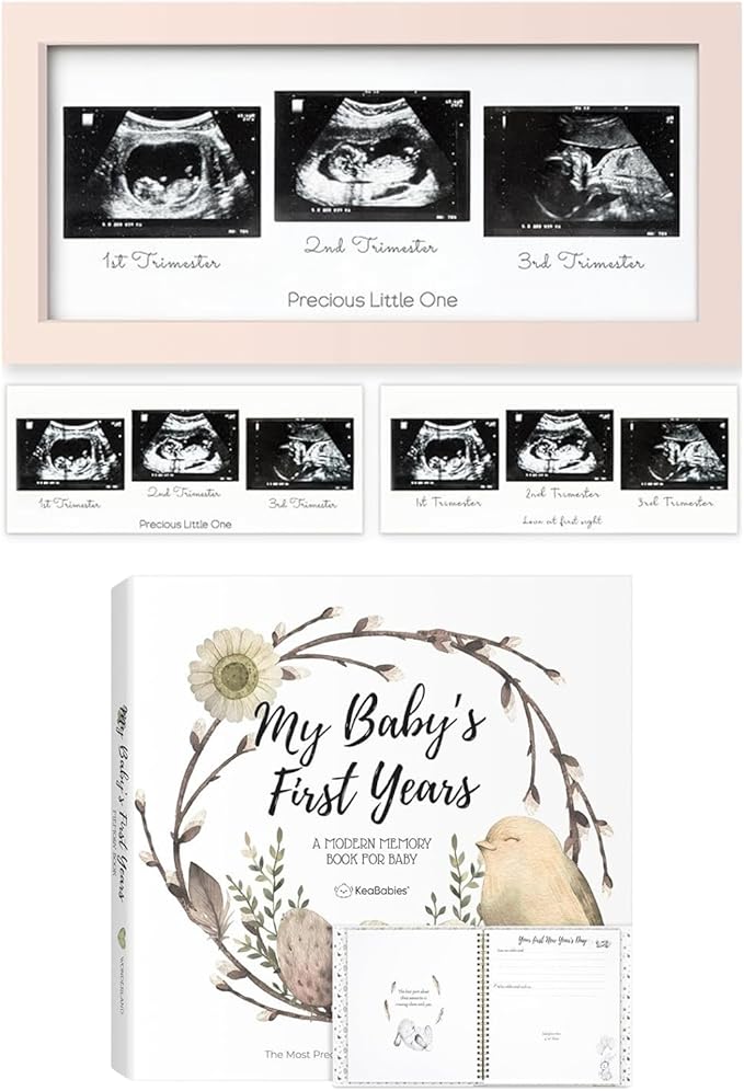 Keababies Sonogram Picture Frame and First 5 Years Baby Memory Book Journal - Trio Ultrasound Picture Frames For Mom To Be Gift - 90 Pages Hardcover First Year Keepsake Milestone Baby Book